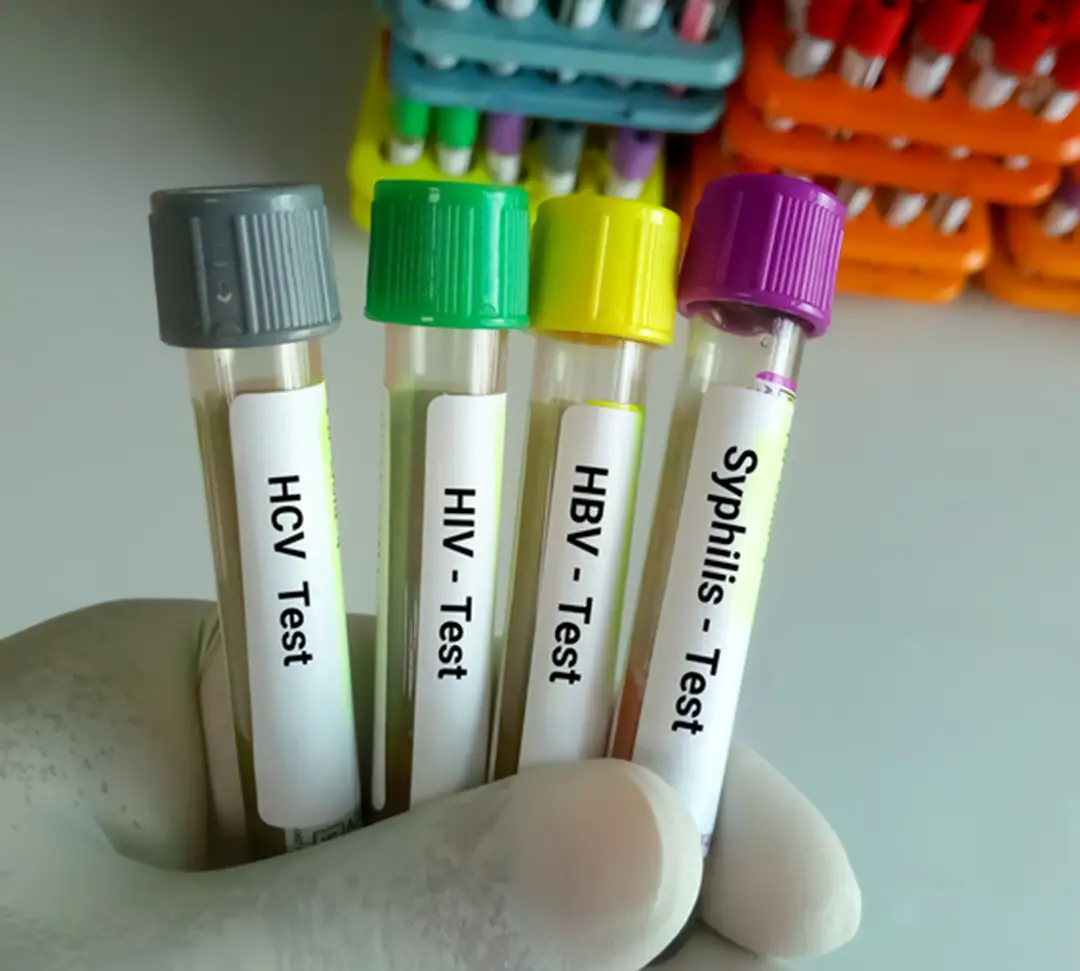 Routine Lab Testing in Clinic